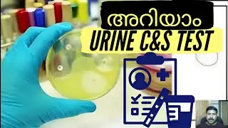Urine Culture & Sensitivity Test Malayalam