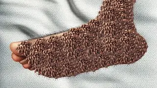 ASMR Animation Treatment l foot warts @asmr100