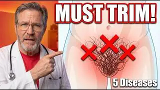 5 Diseases You Can Get If You Don't Trim Your Pubic Hair! (Seniors Alert)