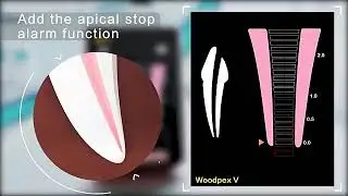 woodpex V