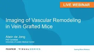 September 2021: Imaging of Vascular Remodeling in Vein Grafted Mice