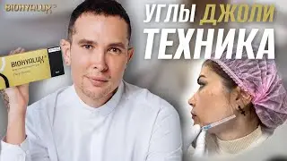 УГЛЫ ДЖОЛИ | СКУЛЫ контурная пластика 