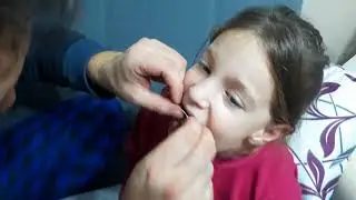 Diş çekimi, tooth pulling, çok heyecanlı.