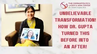 Dr. Gupta's Revolutionary Techniques for an Amazing Transformation! 