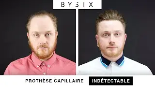 Le complément capillaire indétectable BYSIX | La transformation de Mickaël