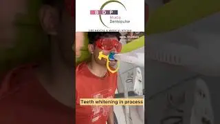 teeth whitening procedure #teethwhitening