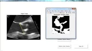 Project Topics Related to Image Processing | Thesis Topics Related to Image Processing