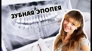ЗУБНАЯ ЭПОПЕЯ: Чудо-импланты!  #стоматология #лечениезубов #имплантация #брекеты #каппы