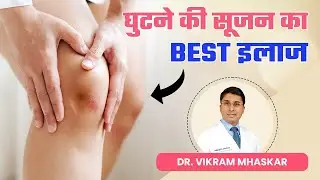 घुटने में सूजन क्या होता है?  घुटने की सूजन का Best इलाज | Best Doctors for Knee Effusion in Delhi