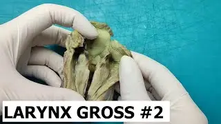 Larynx gross #2