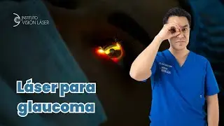 🔍 Láser para Glaucoma: Todo sobre las Iridotomías 🔍