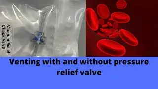 Venting with and without pressure relief valve