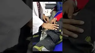 ECP ट्रीटमेंट कैसे किया जाता है? How is ECP treatment done? - Sibia Medical Centre
