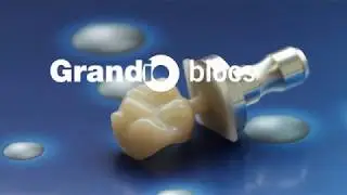 Grandio blocs - clinical images of the nano-ceramic hybrid block