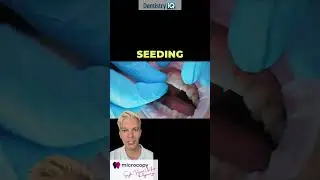 Want predictable and profitable anterior esthetics? You need a great prep