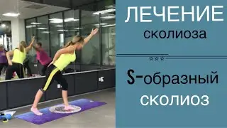 Лечение сколиоза. s-образный сколиоз.Часть 1