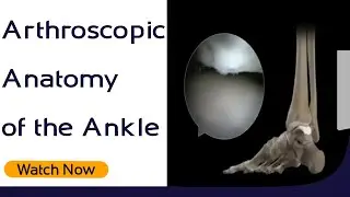 Arthroscopic Anatomy of the Ankle