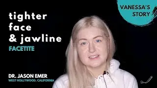 FaceTite: Vanessa's Journey to a Tighter Face & Jawline