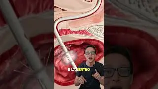 Como voce urina na cirurgia? 😯🚽 