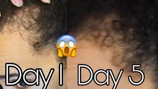 I GREW MY EDGES IN 5 DAYS! Shocking Results