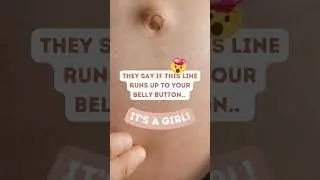 Linea Nigra Predicts Gender? 🤫😲 