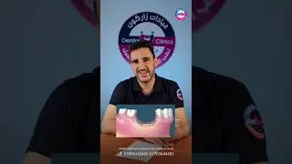 ماذا يحصل عندما تفقد الأسنان بدون تعريضها مع الدكتور علي وليد