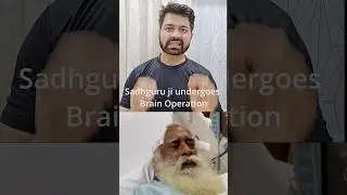 Brain operation for Sadhguru ji. Burrhole evacuation of Chronic sdh. #sadhguru #neurosurgery #neuro