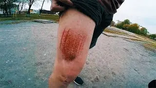 TOP 10 PARKOUR FAILS 2018