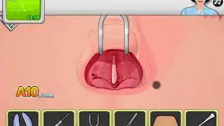 Operate Now Nose Surgery