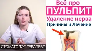 Пульпит - симптомы, причины, лечение пульпита, удаление нерва зуба, пломбирование зубных каналов