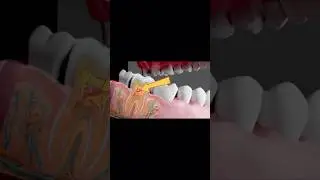 Dente obturado doendo muito