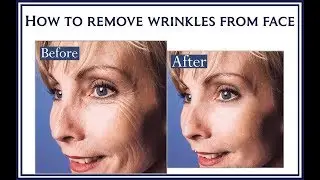 How To Remove Wrinkles From Face using Photoshop