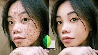 snapseed photo editing face cleaning | how to clean face in snapseed | skin smooth editing
