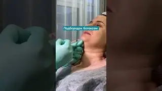 Коррекция подбородка ботоксом.