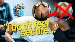 Belly Removal: THIS was my last choice | Plastic Surgery Testimonial