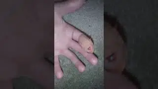 My stiches do not watch if u don't like blood