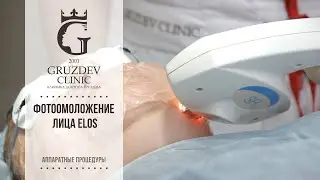 Фотоомоложение лица ELOS