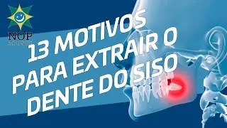 Dente do siso: 13 motivos para extrair