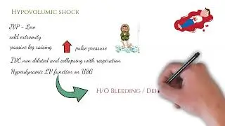 Shock - How to Approach It