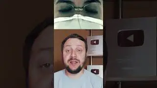 Что это? Что на лице у этой девушки? #shortsце #shots #чтоэто