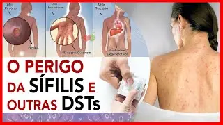 O perigo da Sífilis e outras DSTs