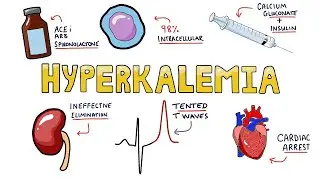 Hyperkalemia - Causes, Symptoms, Diagnosis, and Treatment in Less Than 5 Minutes