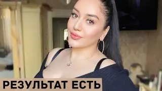 Гоар Аветисян показала первые результаты после пластических операций