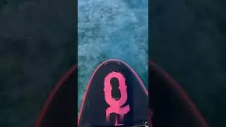 Нашествие медуз в Анапе
