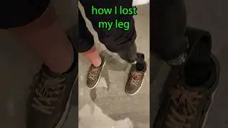 How I Lost My Leg...it hurt.