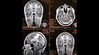 Ge mri reformat