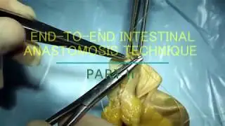 End-to-end intestinal anastomosis technique (part 2: anterior lip)