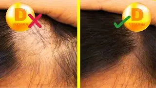 10 Symptoms of Vitamin D Deficiency You should Never Ignore