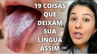 Lingual coating: Discover 19 causes and how to treat WHITE TONGUE and LINGUAL COAT