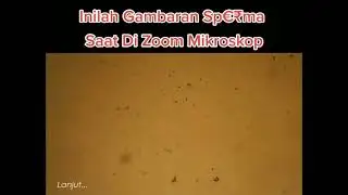 Beginilah Gambaran sperma saat di zoom mikroskop
